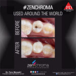 ZENCHROMA - Universal Composite - Image 3